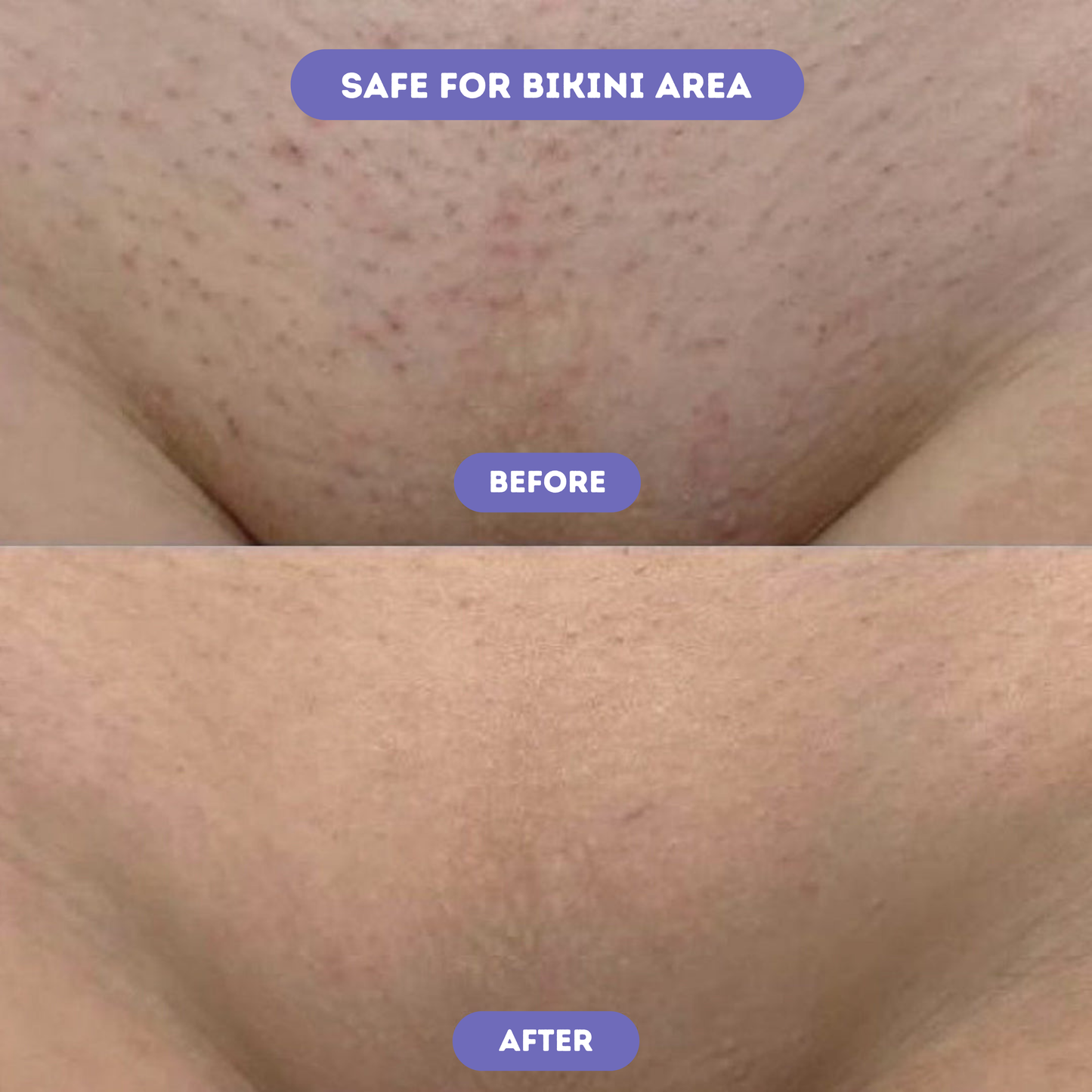 Moditek™ Crystal Hair Eraser